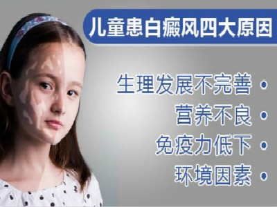 儿童白癜风有哪些症状